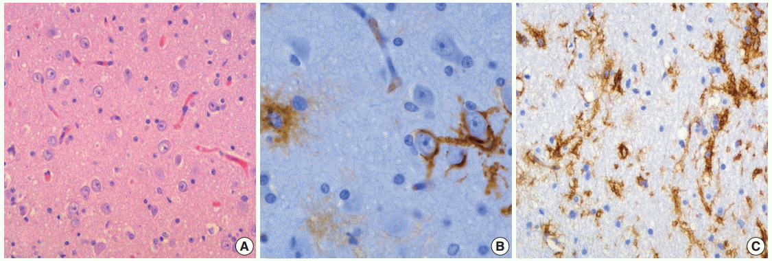 jptm-2015-10-05f5.gif