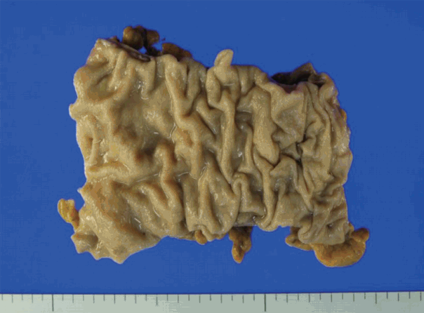 jptm-2016-09-07f2.gif