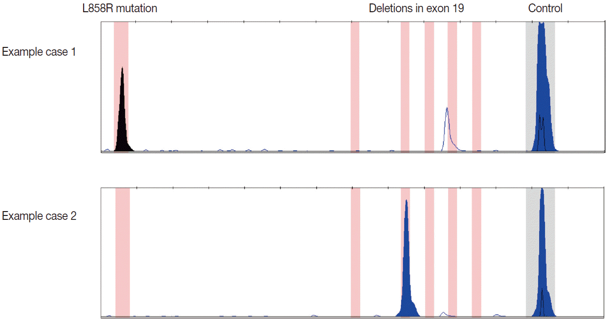 jptm-49-4-300f2.gif