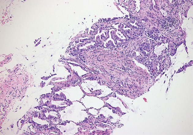 kjpathol-46-101-g002.jpg