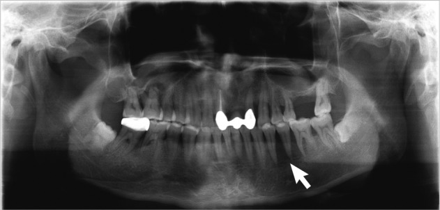 kjpathol-46-101-g003.jpg