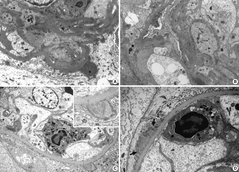 kjpathol-46-105-g003.jpg