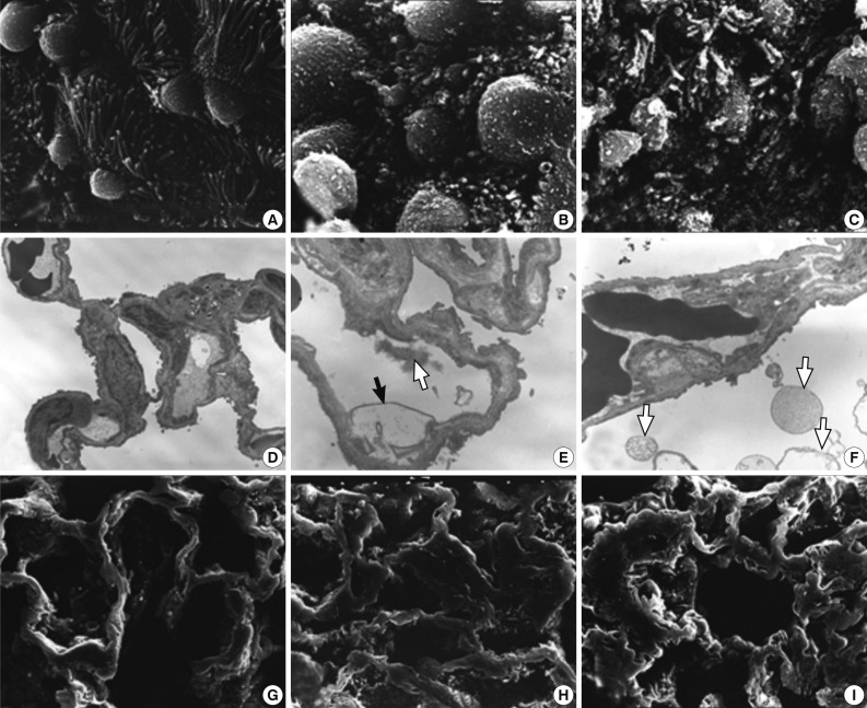 kjpathol-46-151-g003.jpg
