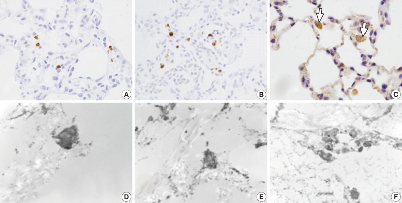 kjpathol-46-151-g005.jpg