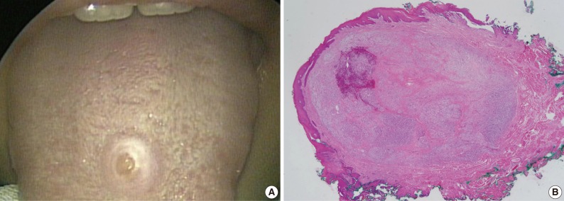 kjpathol-46-192-g001.jpg