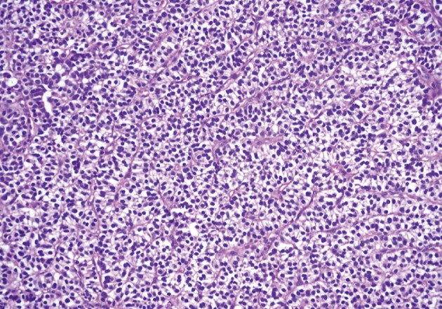 kjpathol-46-197-g003.jpg