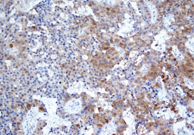 kjpathol-46-197-g006.jpg