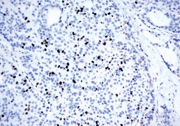 kjpathol-46-197-g007.jpg