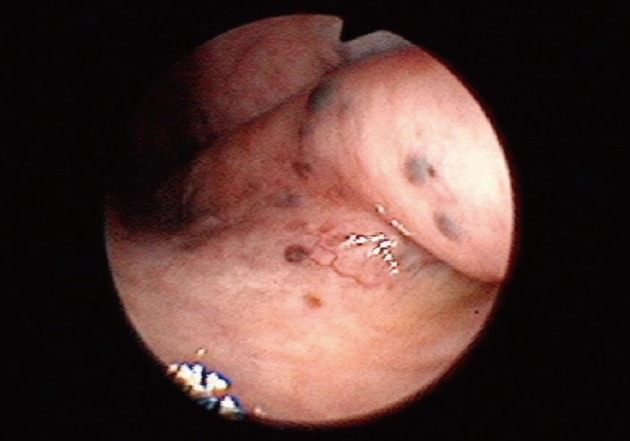kjpathol-46-201-g001.jpg