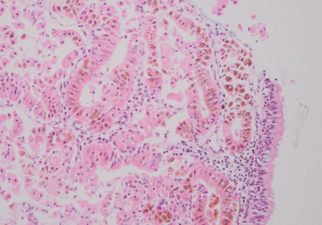 kjpathol-46-201-g002.jpg