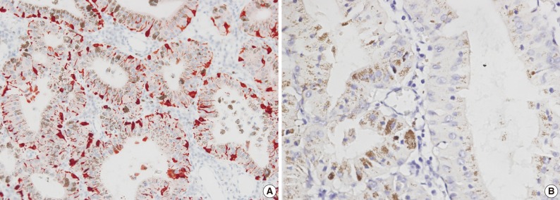 kjpathol-46-201-g003.jpg