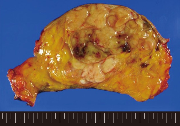 kjpathol-46-205-g001.jpg