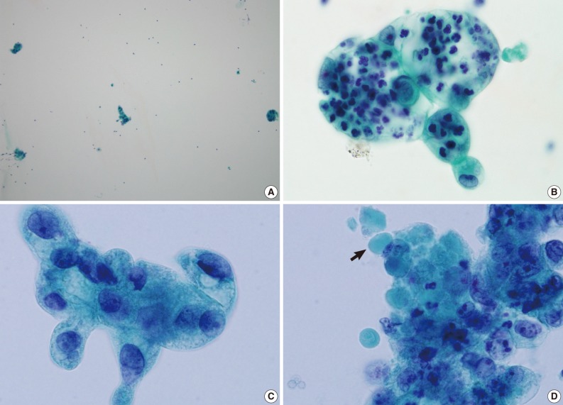 kjpathol-46-210-g002.jpg