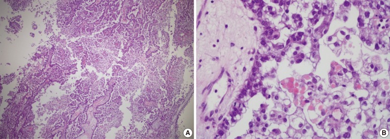kjpathol-46-210-g003.jpg