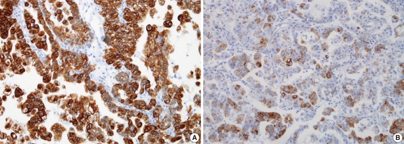 kjpathol-46-210-g004.jpg