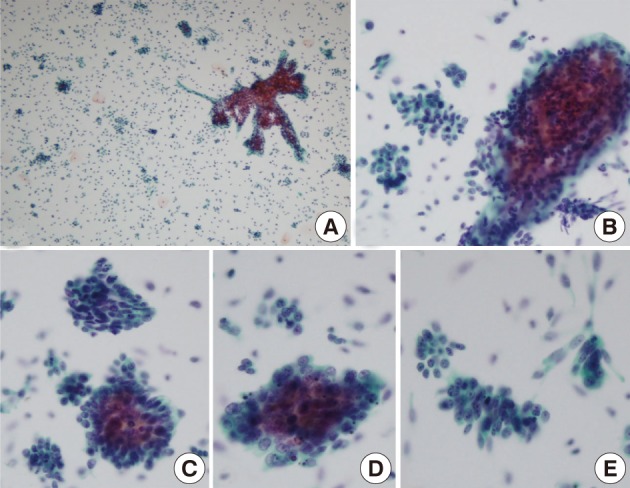 kjpathol-46-215-g001.jpg