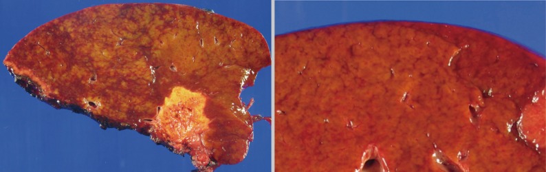 kjpathol-46-22-g001.jpg