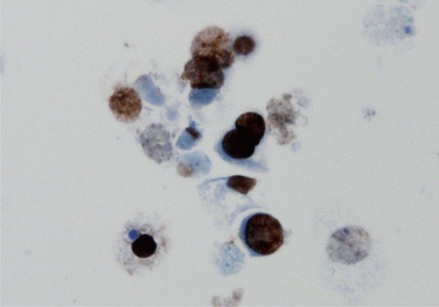 kjpathol-46-233-g002.jpg