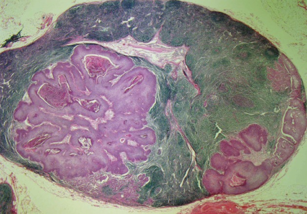 kjpathol-46-278-g003.jpg