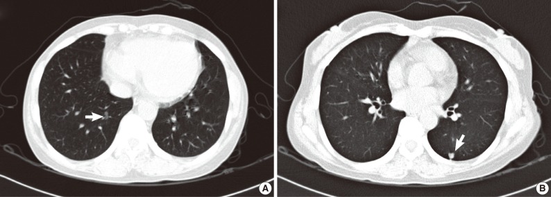 kjpathol-46-282-g002.jpg