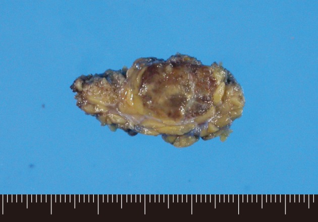 kjpathol-46-297-g002.jpg