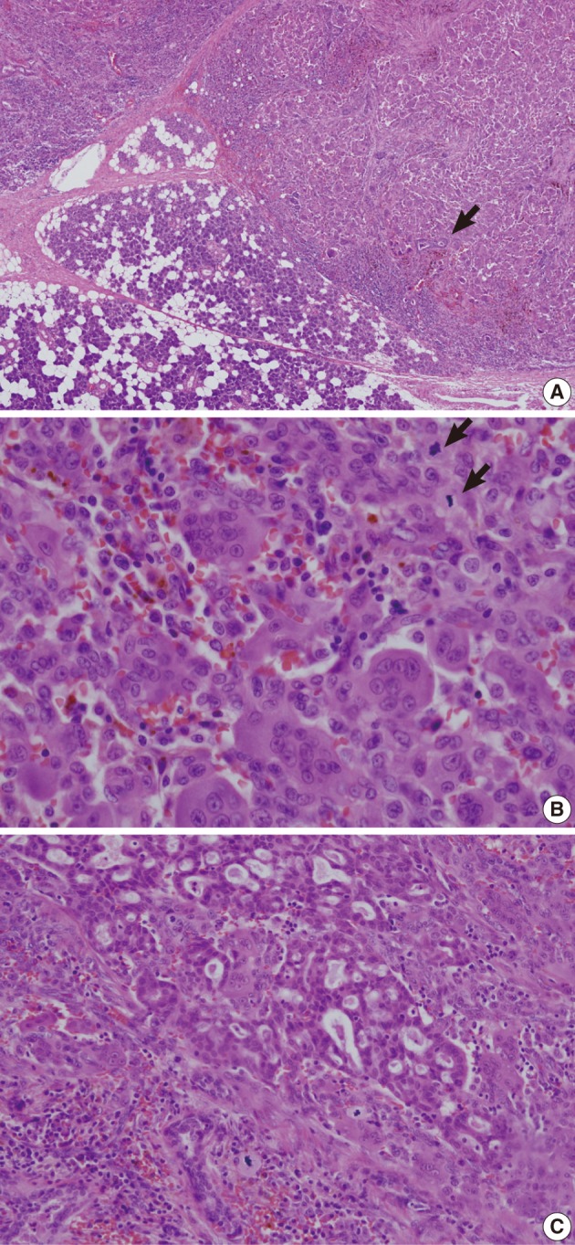 kjpathol-46-297-g003.jpg