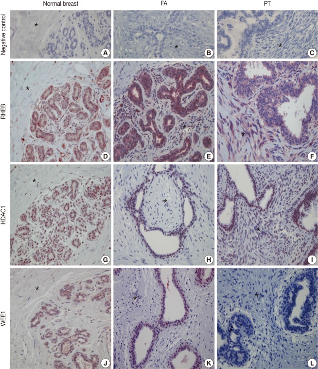 kjpathol-46-324-g001.jpg