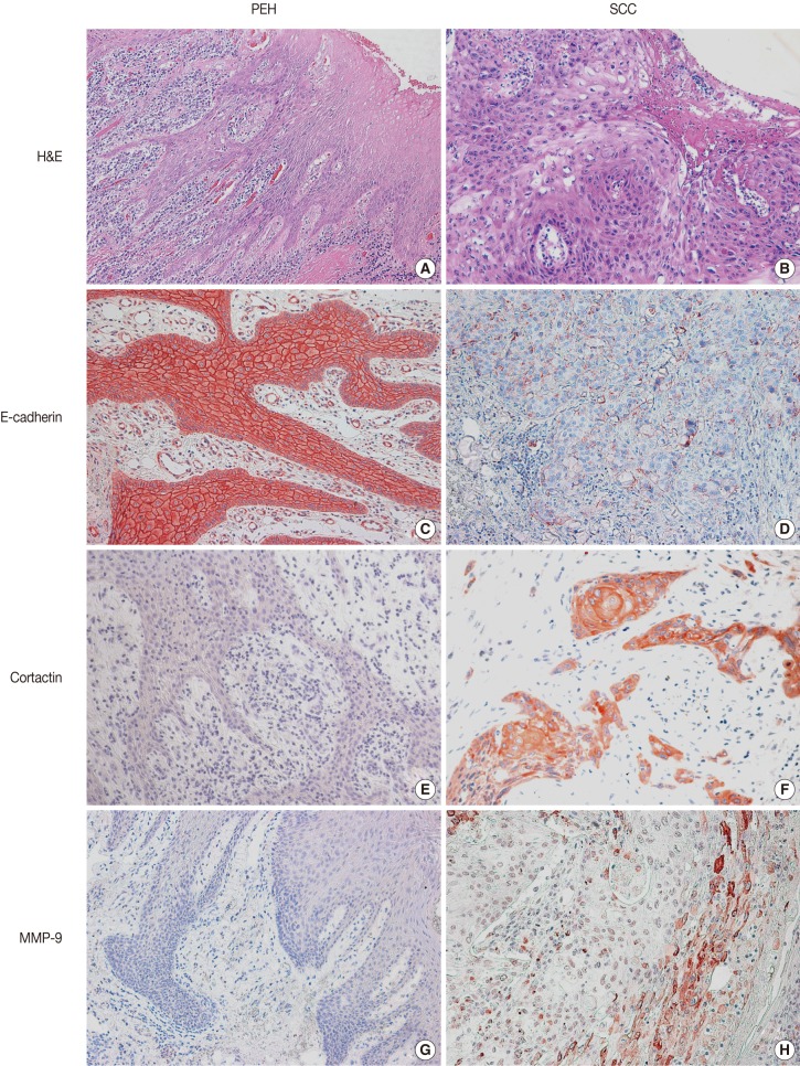 kjpathol-46-331-g001.jpg