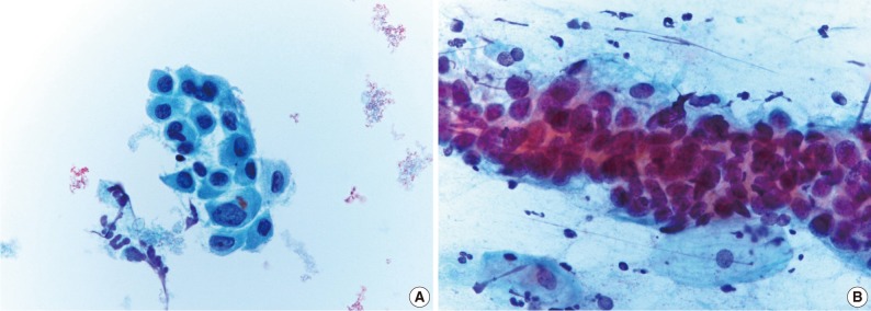 kjpathol-46-365-g002.jpg