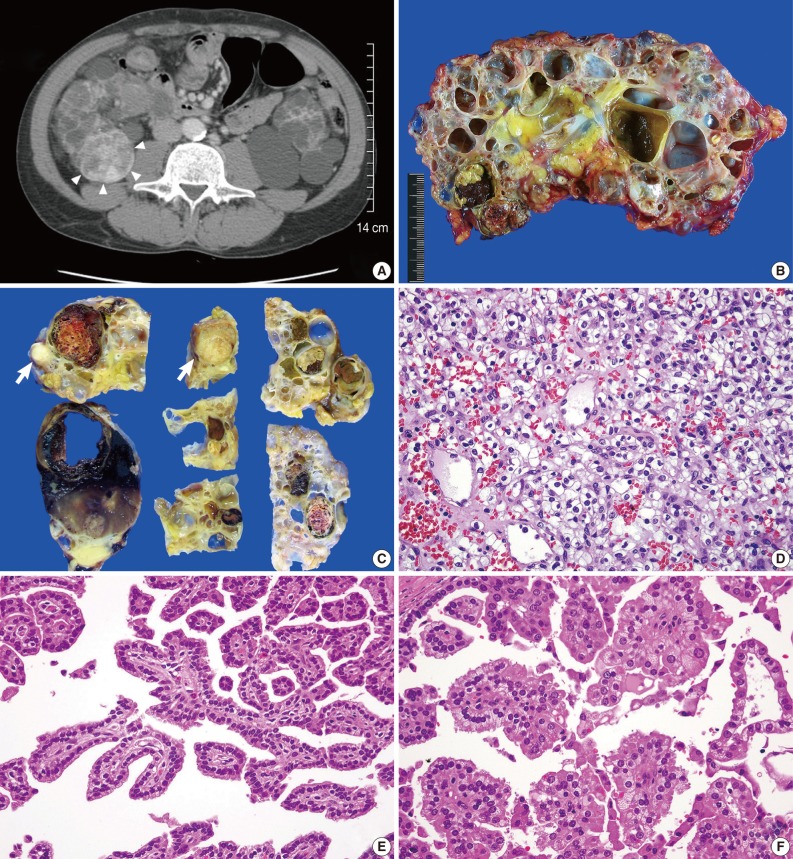 kjpathol-46-382-g001.jpg