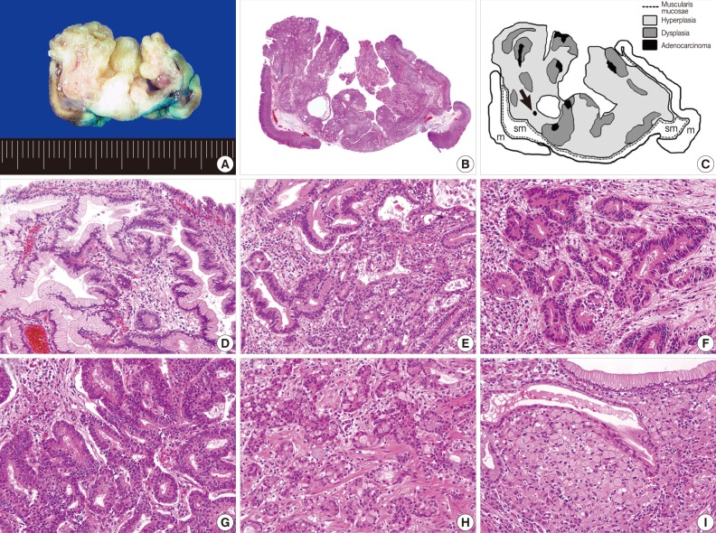 kjpathol-46-387-g002.jpg