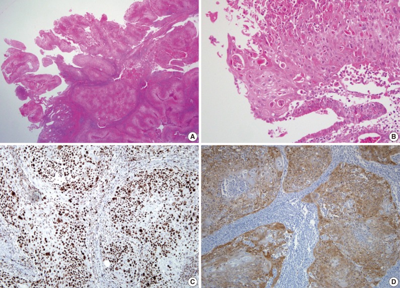 kjpathol-46-395-g001.jpg