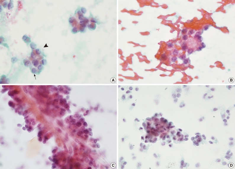 kjpathol-46-399-g002.jpg