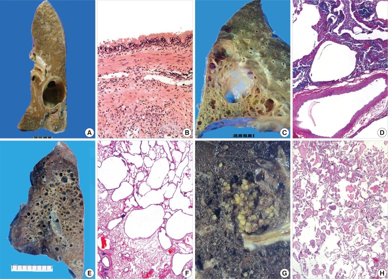 kjpathol-46-407-g001.jpg