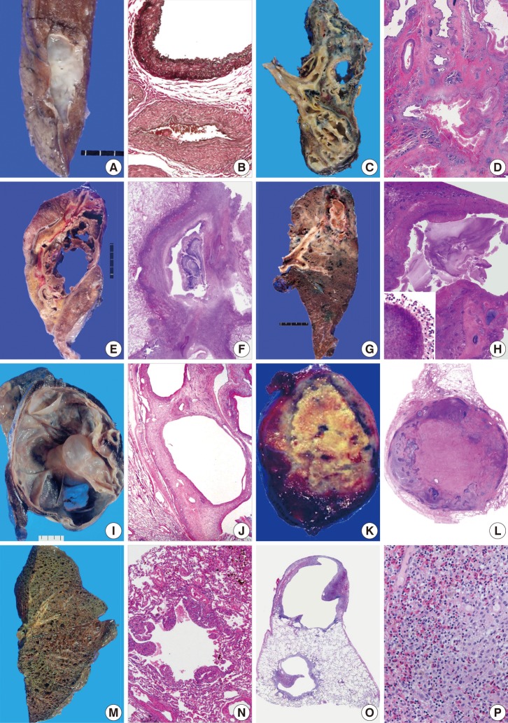 kjpathol-46-407-g002.jpg