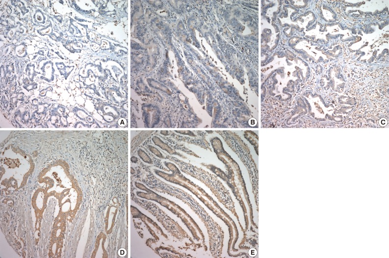 kjpathol-46-415-g001.jpg