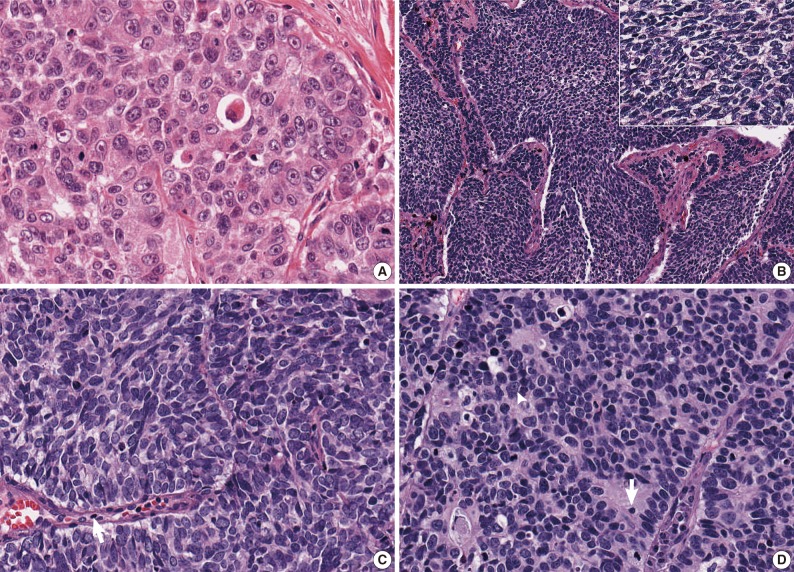 kjpathol-46-42-g001.jpg