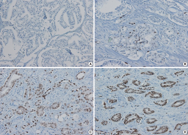 kjpathol-46-423-g001.jpg