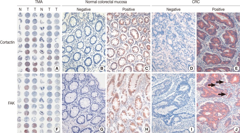 kjpathol-46-454-g001.jpg