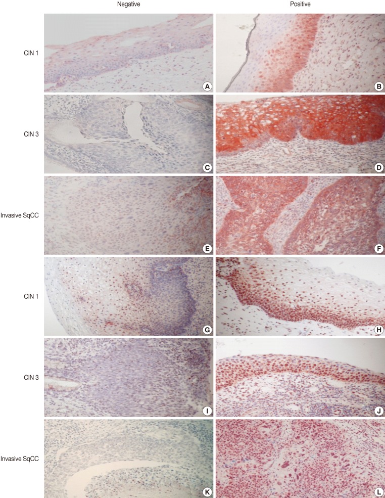 kjpathol-46-463-g001.jpg