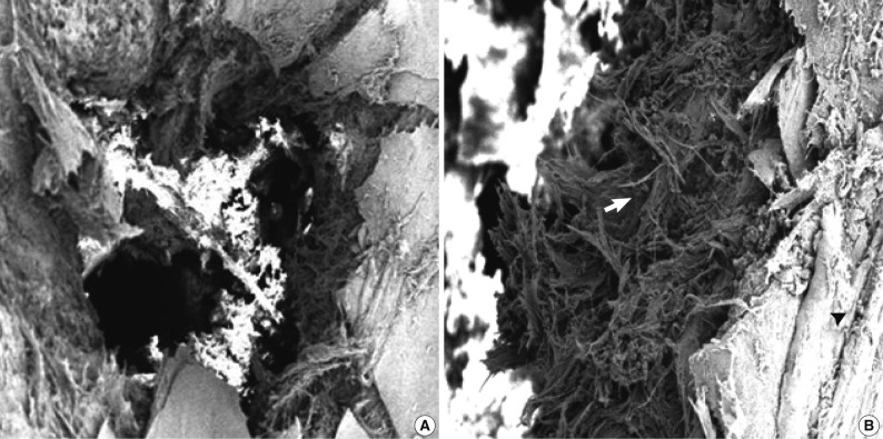 kjpathol-46-48-g003.jpg