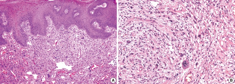 kjpathol-46-494-g001.jpg