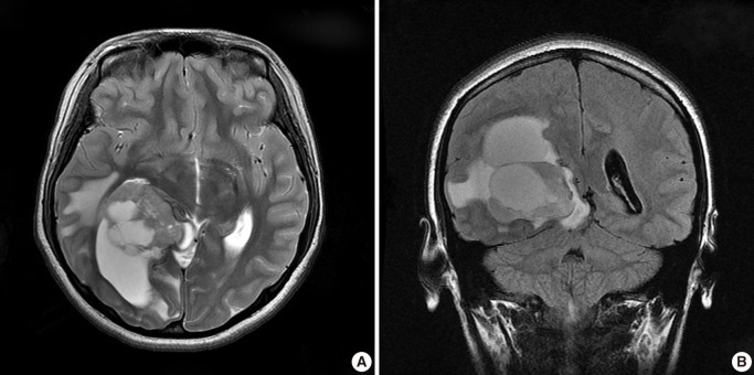 kjpathol-46-507-g001.jpg