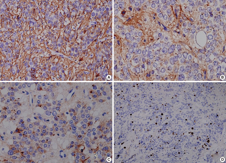 kjpathol-46-507-g004.jpg