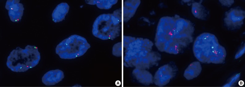 kjpathol-46-515-g003.jpg