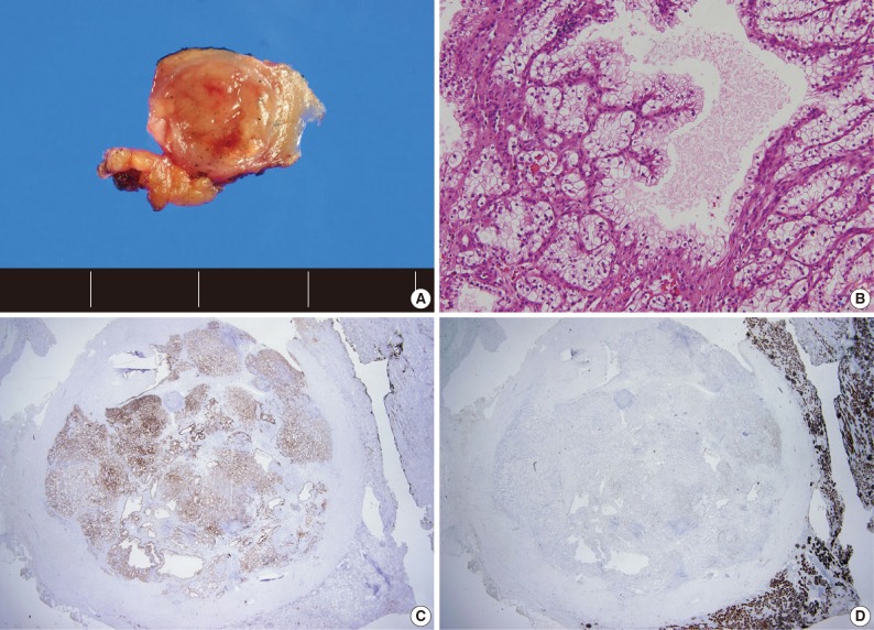 kjpathol-46-541-g001.jpg