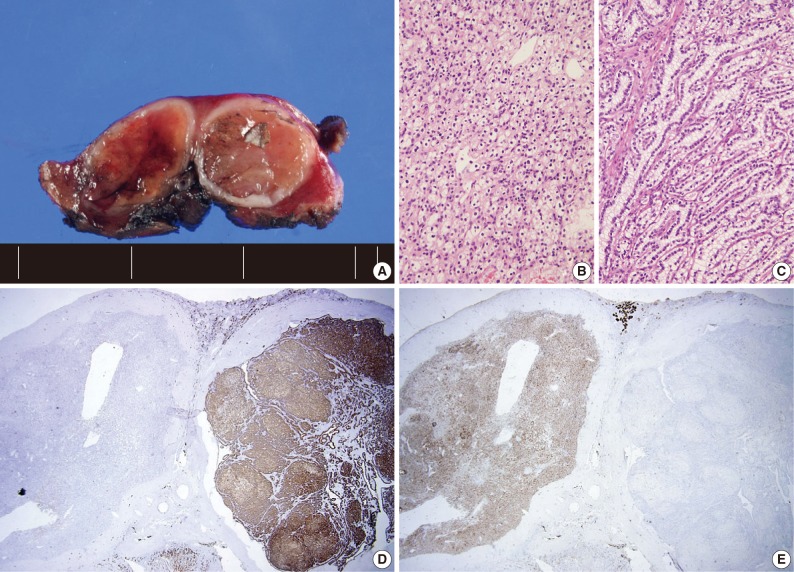 kjpathol-46-541-g002.jpg