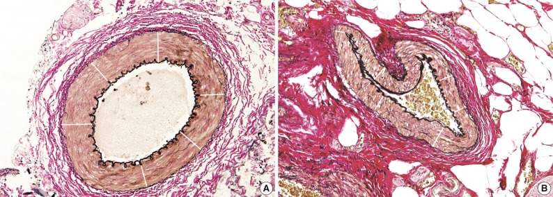 kjpathol-46-548-g002.jpg