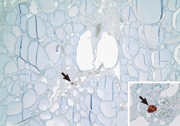 kjpathol-46-548-g003.jpg