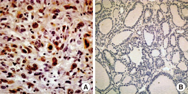 kjpathol-46-55-g002.jpg